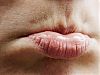 Напуканите устни: как да се справим с проблема