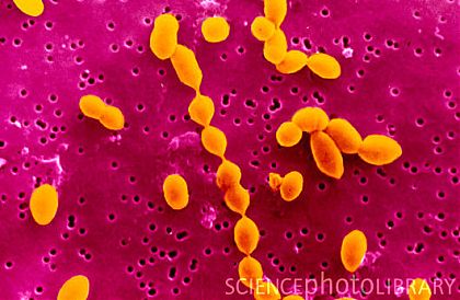10-те най-вредни вируси и бактерии