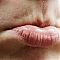 Напуканите устни: как да се справим с проблема